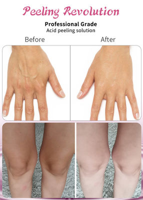 Loại huyết thanh làm da da chất lượng cao thúc đẩy tái tạo collagen và nâng da lên
