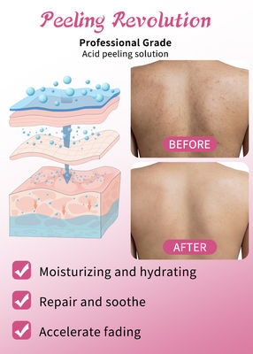 Xử lý da Xử lý da Xử lý da Xử lý mụn Xử lý da Xử lý da Xử lý da 30ml