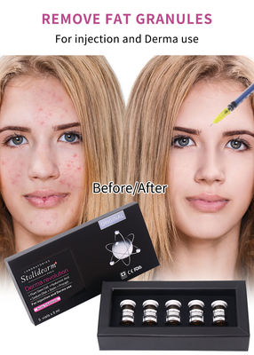 Stalidearm Dermal Fillers Điều trị mụn trứng cá Serum tiêm để chữa mụn trứng cá và giảm vết bẩn