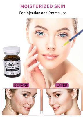 Stalidearm Hyaluronic Acid Injectable Face Serum Cho Sự Tăng cường da & Mesotherapy
