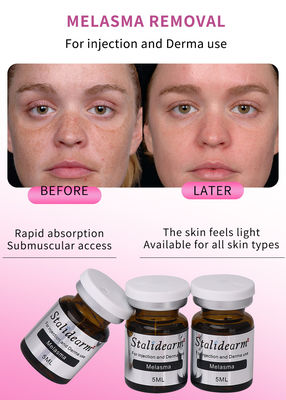 Stalidearm Fillers Da cải thiện sự xuất hiện của Freckle chăm sóc da khuôn mặt điều trị melasma