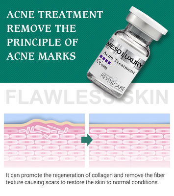 Mesotherapy Pure Plant Pimple Clear Serum Điều trị Sẹo mụn