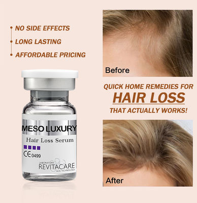 Thảo dược điều trị mọc lại tóc tự nhiên 10ml Nhãn riêng tùy chỉnh