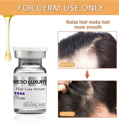 Thảo dược điều trị mọc lại tóc tự nhiên 10ml Nhãn riêng tùy chỉnh