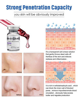 Giải pháp Mesotherapy Exosome Dermal Pen Skin Whitening Serum Set MESO Luxury Được xây dựng ở Pháp
