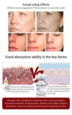 Tinh chất làm sáng da Meso làm săn chắc da Microneedling Mesotheraphy Caviar Essence Serum