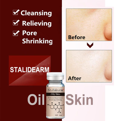 Huyết thanh thảo dược hữu cơ chống mụn trứng cá nhãn tùy chỉnh Dermapen Face Essence cho da nhờn