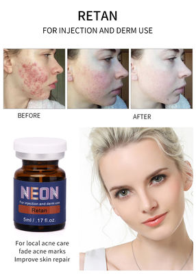 Neon Meso Therapy Serum Tiêm Serum trị mụn 5ml Tinh chất nguyên chất