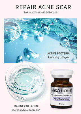 Điều trị mụn bằng tiêm Mesotherapy Luxury Youth Serum Injection Red Spots
