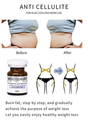 Meso Anti Cellulite Serum Giảm Béo Giảm Cân Đốt Mỡ Bụng
