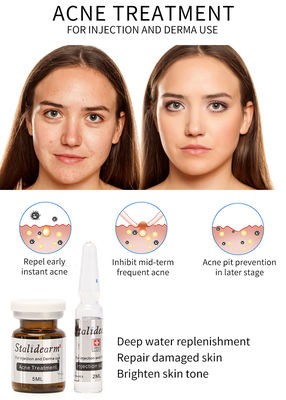 Huyết thanh điều trị mụn Stalidearm Mesotherapy Nuôi dưỡng không có tác dụng phụ