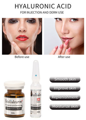 Tiêm huyết thanh thanh niên Hyaluronic Acid 5ml microneedling chống lão hóa
