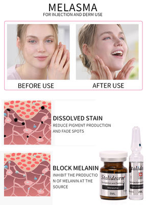 Công Dụng Tiêm Trị Nám Bộ Serum Mesotherapy An Toàn Và Hiệu Quả Tốt 5ml / lọ