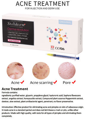 Liệu pháp Mesotherapy điều trị mụn bằng Exosome, Skin Booster, Botox
