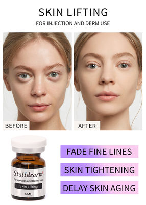 Stalideram Anti Aging Skin Lifting Tiêm Huyết thanh Đầu tiêm Chăm sóc da PRP tự nhiên hiệu quả tốt